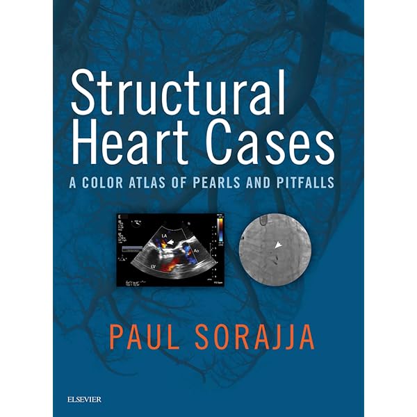 Amazon.com: Mastering Structural Heart Disease eBook : de Marchena